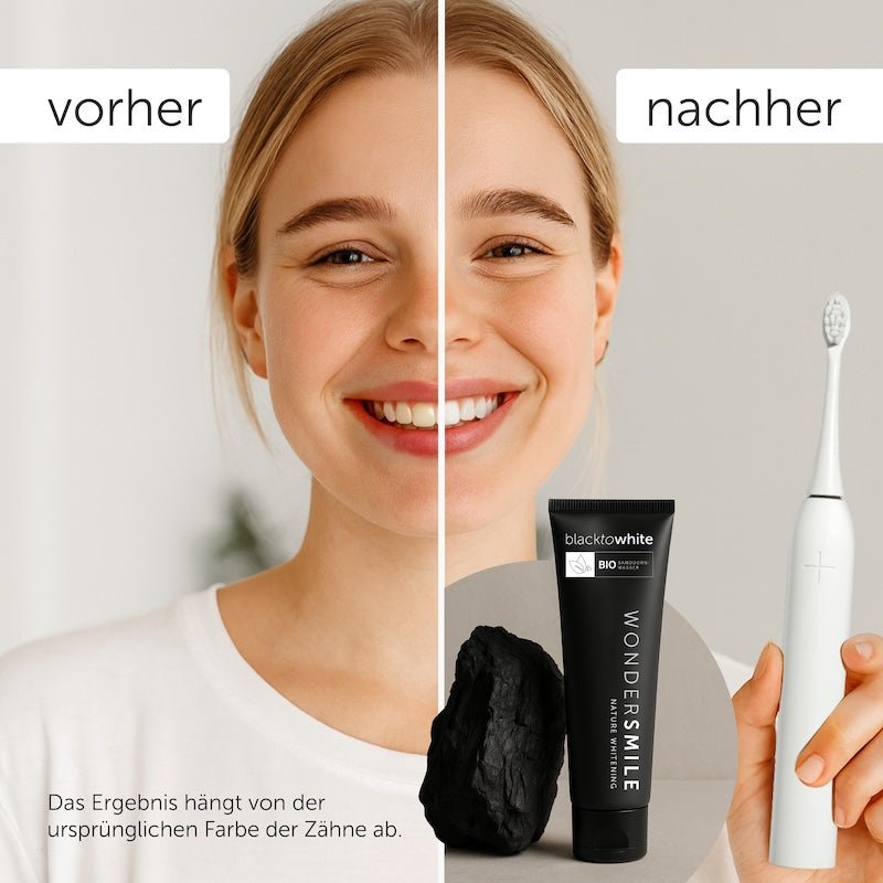 Vorher-nachher: hellere Zähne mit der Aktivkohle-Zahnpasta