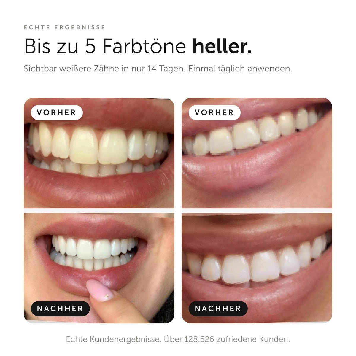 Whitening Strips - WonderSmile GmbH
